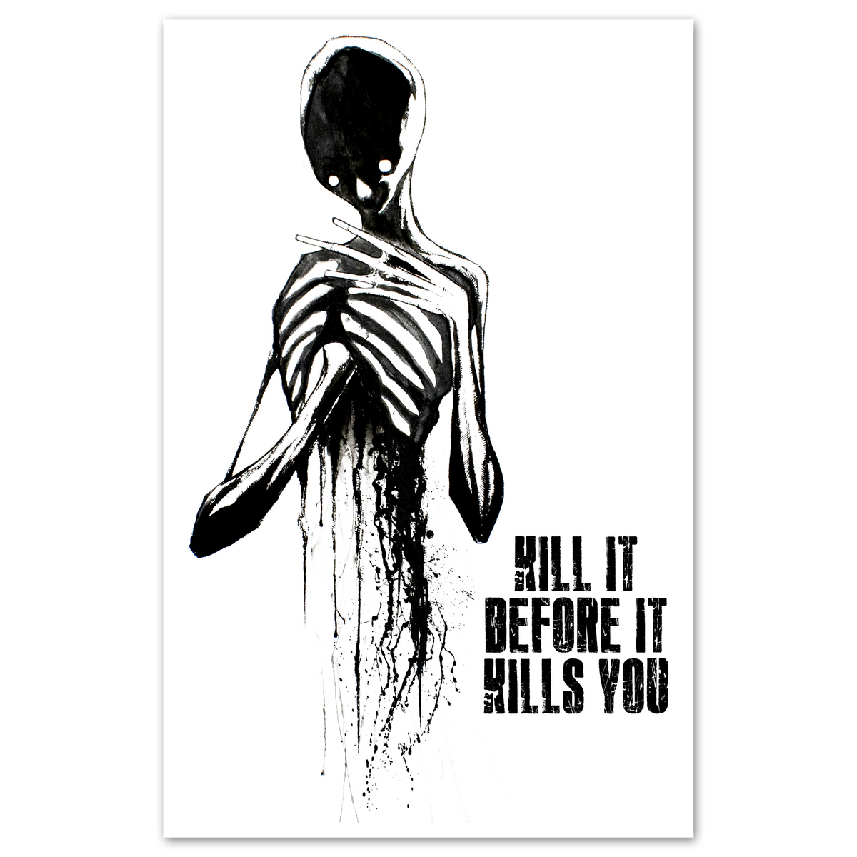 Kill It Before It Kills You Print